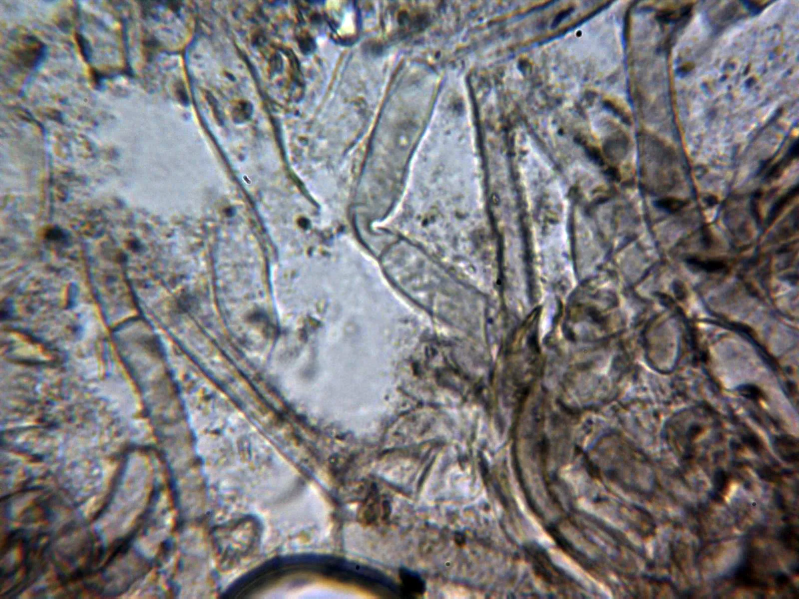 Microscopía de Tricholoma bufonium - 10 -  Cutícula sin fíbulas